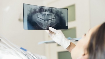Quy trình chụp X quang răng được thực hiện như thế nào?