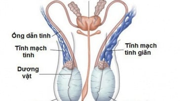 Giãn tĩnh mạch thừng tinh trên siêu âm