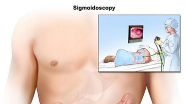 Nội soi đại tràng Sigma