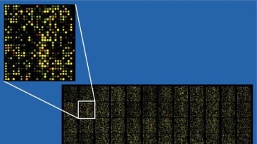 Ứng dụng của Microarray trong chẩn đoán sau sinh