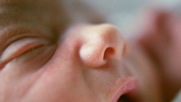 Một số bệnh về mắt thường gặp ở trẻ sơ sinh