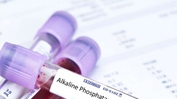 Ý nghĩa của xét nghiệm phosphatase kiềm (ALP) trong chẩn đoán bệnh gan xương