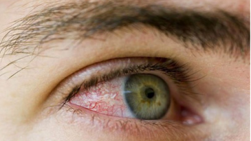 Viêm màng bồ đào gây ra những vấn đề gì về mắt?