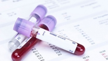 Phương pháp đánh giá rối loạn miễn dịch tại niêm mạc tử cung khi IVF nhiều lần thất b