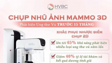 Chụp Nhũ Ảnh 3D Tomosynthesis: Bước Đột Phá Giúp Phát Hiện Ung Thư Vú Sớm Hơn