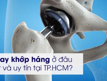 Địa chỉ thay khớp háng uy tín tại TP.HCM