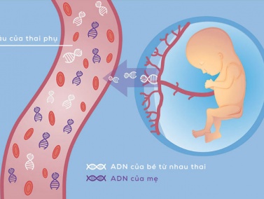 Xét nghiệm NIPT 7 giúp sàng lọc những dị tật nào? Đối tượng nào nên thực hiện NIPT 7?