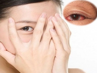 Top 6 Bác Sĩ Chữa Viêm Giác Mạc Giỏi Tại Hà Nội