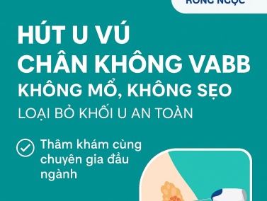 Hút u vú chân không VABB tại Hồng Ngọc: Không mổ, không sẹo, loại bỏ khối u an toàn