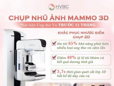 Chụp Nhũ Ảnh 3D Tomosynthesis: Bước Đột Phá Giúp Phát Hiện Ung Thư Vú Sớm Hơn