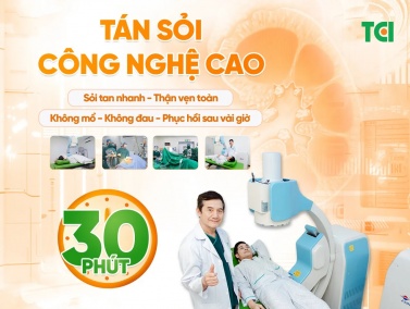 Tán sỏi thận – tiết niệu công nghệ cao tại Thu Cúc TCI: Không mổ mở, sạch sỏi nhanh, bảo tồn chức năng thận