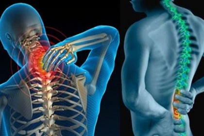 Gai cột sống là bệnh gì? có chữa được không?