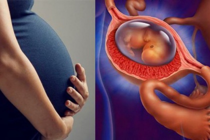 Thai ngoài tử cung có sinh được không hay bắt buộc phải điều trị?