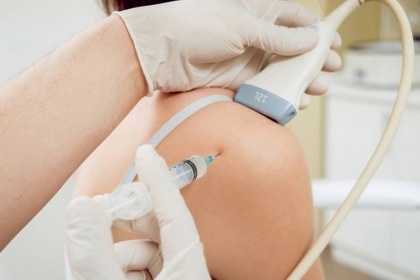Điều trị viêm chóp xoay khớp vai bằng huyết tương giàu tiểu cầu
