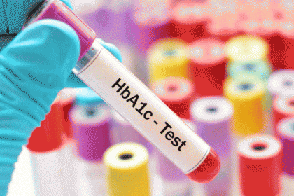 Ý nghĩa xét nghiệm HbA1c trong kiểm soát glucose ở bệnh nhân đái tháo đường