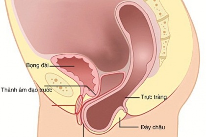 Sa trực tràng là bệnh gì? Nguyên nhân và dấu hiệu nhận biết