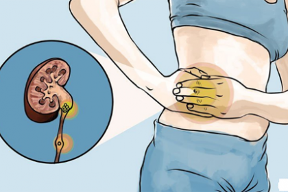 Đau do sỏi tiết niệu diễn ra như thế nào?