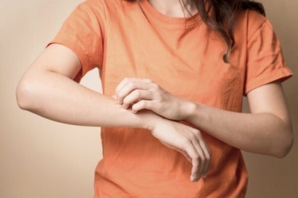 Sốt xuất huyết bị ngứa, mẩn đỏ ngoài da là bình thường hay bất thường?
