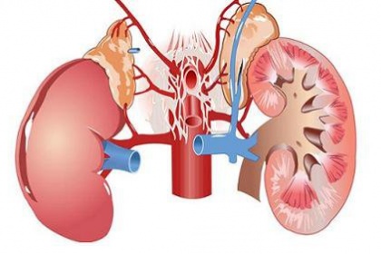Triệu chứng của suy thận mạn thường âm thầm, không rõ ràng