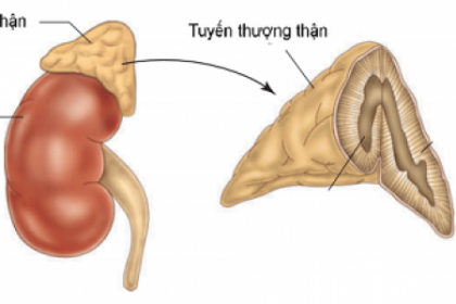 Suy tuyến thượng thận cấp - Nguyên nhân và triệu chứng
