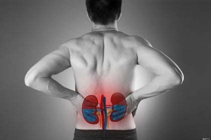 Thận ứ nước - Chẩn đoán và điều trị