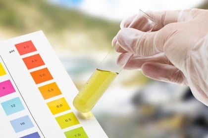 Ý nghĩa chỉ số KET (Ketone) trong xét nghiệm nước tiểu