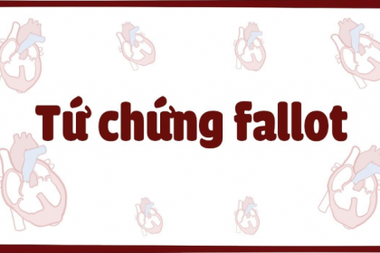 Tứ chứng Fallot là bệnh gì? có Triệu chứng như thế nào?