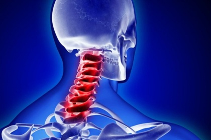 Đốt sống cổ: Đặc điểm, chức năng và Các bệnh thường gặp