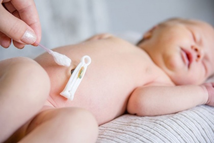 Hướng dẫn Cách chăm sóc rốn cho trẻ sơ sinh