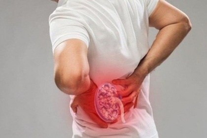 Điều cần làm sau tán sỏi thận qua da để sỏi không tái phát