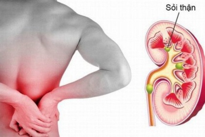 Các phương pháp điều trị sỏi thận