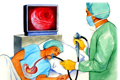 Nội soi dạ dày thực quản cấp cứu chảy máu tiêu hóa cao để chẩn đoán và điều trị
