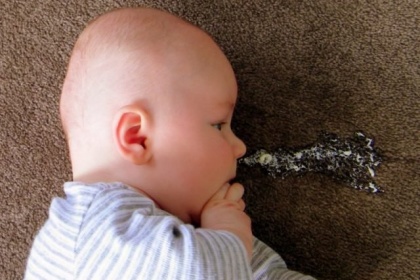 Chẩn đoán và điều trị trào ngược dạ dày ở trẻ sơ sinh