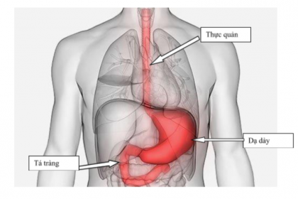 Những điều cần biết về ung thư dạ dày
