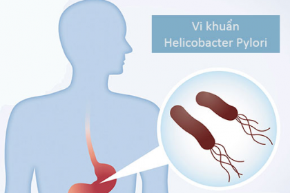 Vi khuẩn HP khi nào sẽ gây ung thư dạ dày?
