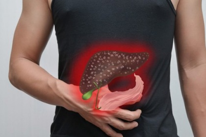 Trào ngược mật: Nguyên nhân, triệu chứng