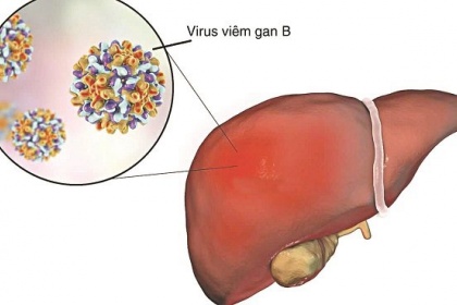 Những điều cần biết khi sử dụng thuốc kháng virus viêm gan B
