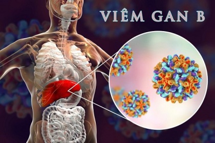 Vì sao nhiễm siêu vi viêm gan B có nguy cơ dẫn tới Xơ gan và ung thư gan?