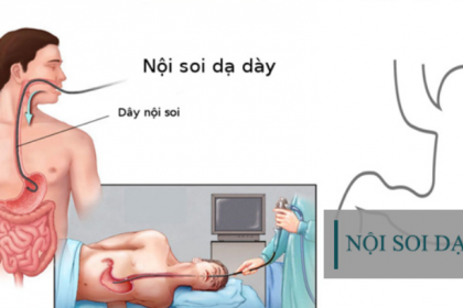 Tại sao phải nội soi dạ dày?