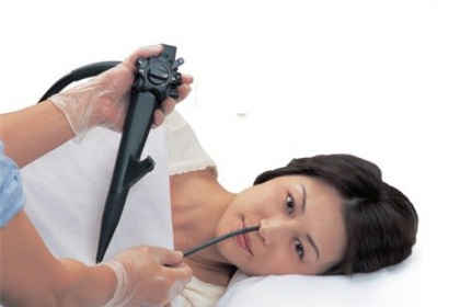 Ưu điểm của nội soi tiêu hóa qua đường mũi