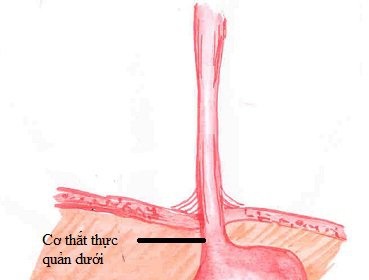 Các biểu hiện của bệnh co thắt tâm vị