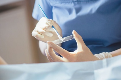Một số yếu tố ảnh hưởng đến kết quả xét nghiệm sàng lọc ung thư cổ tử cung và cách ph
