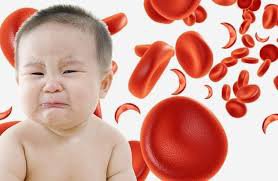 Thiếu máu sơ sinh: Những điều cần biết