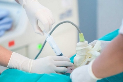 Chọc ối dưới hướng dẫn của siêu âm