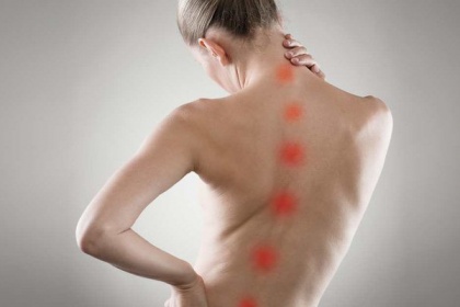 Phục hồi chức năng cho bệnh nhân vẹo cột sống
