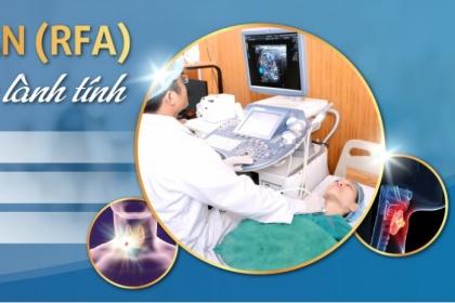 Đốt sóng cao tần (RFA) điều trị u tuyến giáp lành tính với chi phí hợp lý