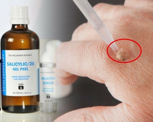 Ảnh của Axit Salicylic
