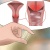 Viêm nhiễm âm đạo là nguyên nhân hàng đầu gây tắc ống dẫn trứng