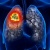 Ung thư phổi: Nguyên nhân, triệu chứng