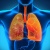 Những điều cần biết về bệnh viêm phổi hít